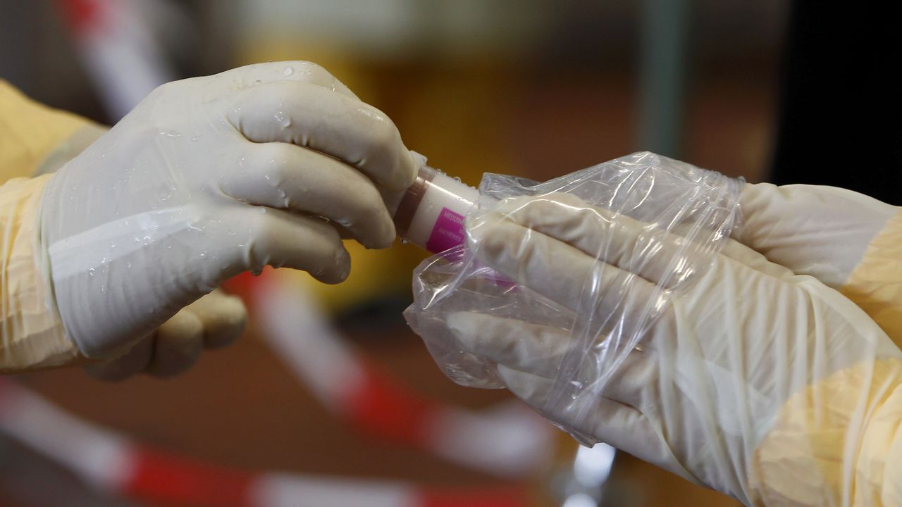 Ebola