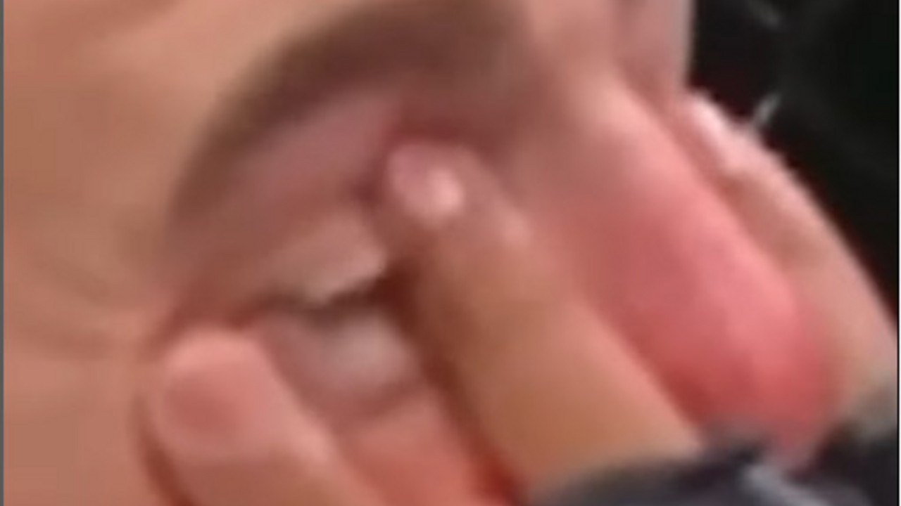 Tom Aspinal doživeo vrlo neprijatnu povredu